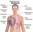/album/fotogaleria/sintomas-malaria2-copia-jpg/